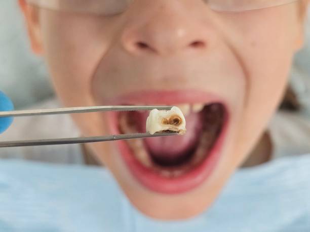 Best Emergency Pediatric Dentist  in Erie, KS